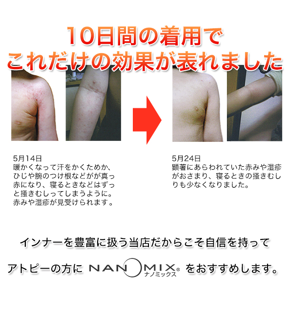 ナノミックス ベーシック レース付きロングスパッツ M〜LL (レディース 婦人 レギンス スパッツ インナー 下着 アトピー 敏感肌 乾燥肌 日本製)